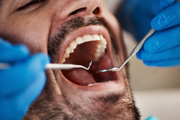 Best Broken or Chipped Tooth Repair in Hasbrouck Heights, NJ